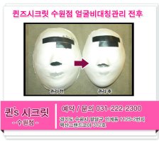 수원얼굴축소2