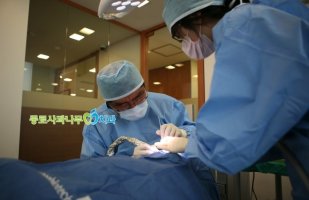 앞니인플란트가격3