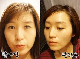 강남피부관리샵1