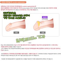음경확대비용1