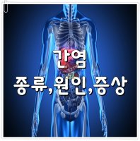 고지혈증종류5