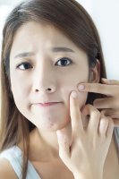 여드름피부관리1