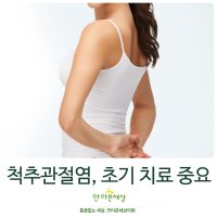 척추관절염6