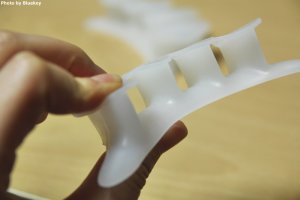 무지외반증교정1