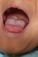 김해이비인후과4