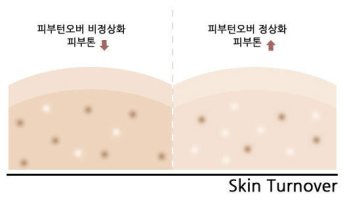 여드름빨간자국5