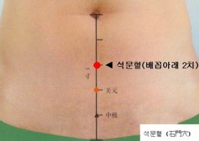 생리통치료법4