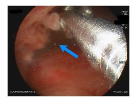 비뇨기과여의사1