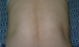 관악구정신병원5