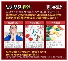 발기부전증상4