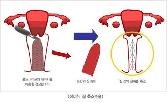 도봉동산부인과4