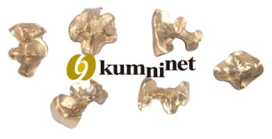 금니씌우는가격1