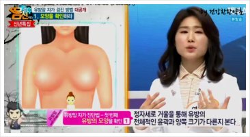 유방암자가진단4