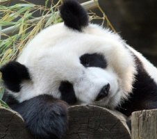 다크써클수술가격4