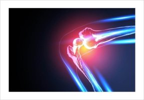 퇴행성관절염운동1