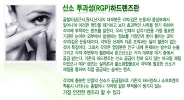 콘택트렌즈종류5