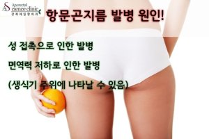항문곤지름3