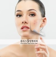 대전여드름관리2