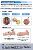 음경확대비용3