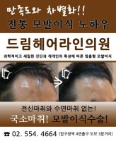 머리카락이식수술5