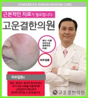 지루성피부염연고1