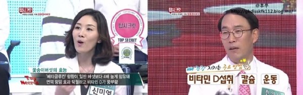 손가락관절염증상1