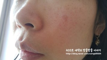 크리니크안티블레미쉬2