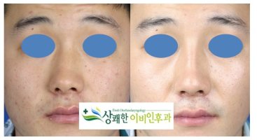 동탄이비인후과2