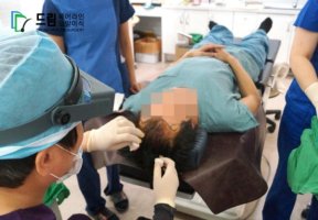 가르마모발이식1