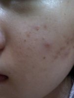 달팽이크림사용법3