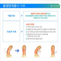 음경만곡수술3
