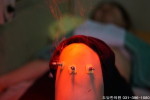 교통사고정형외과2