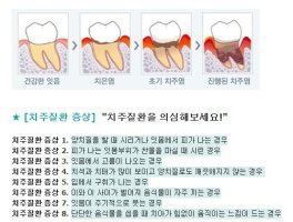 치주질환3